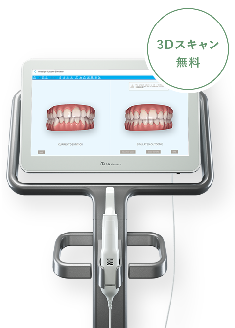 3Dスキャン無料