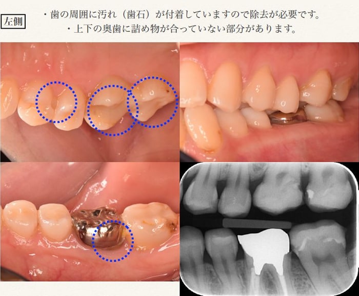 Step2 検査結果説明