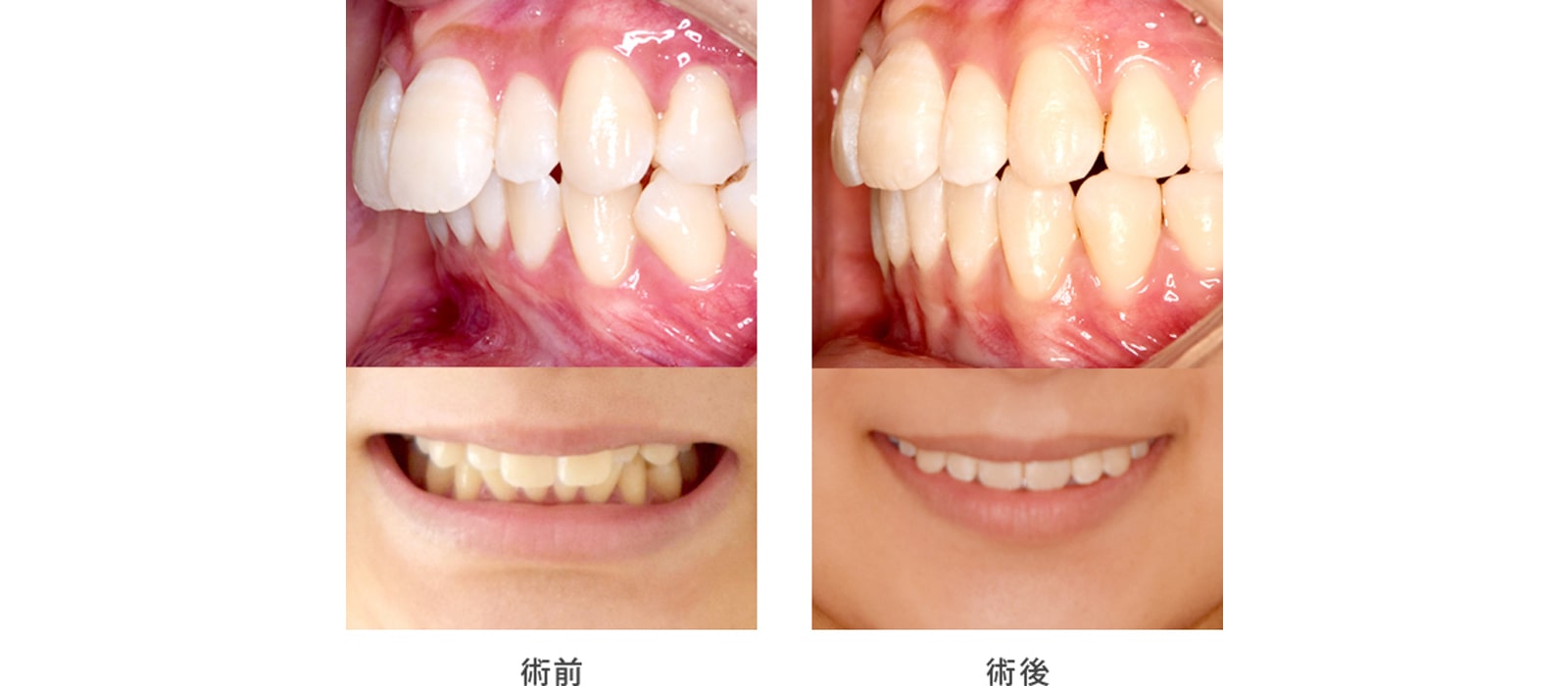 歯並び以外の要素も考慮してお仕上げします