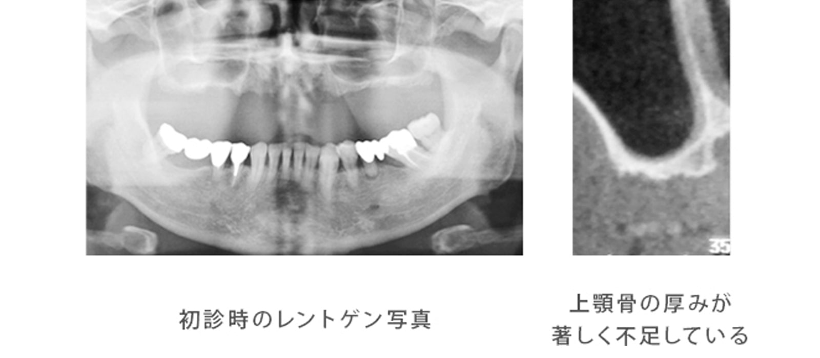 断られた理由はなんだったのか？レントゲン診査の結果は？