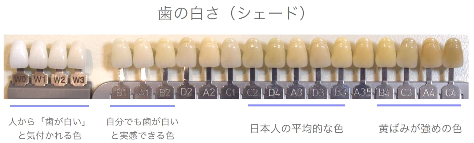 歯の白さ（シェード）